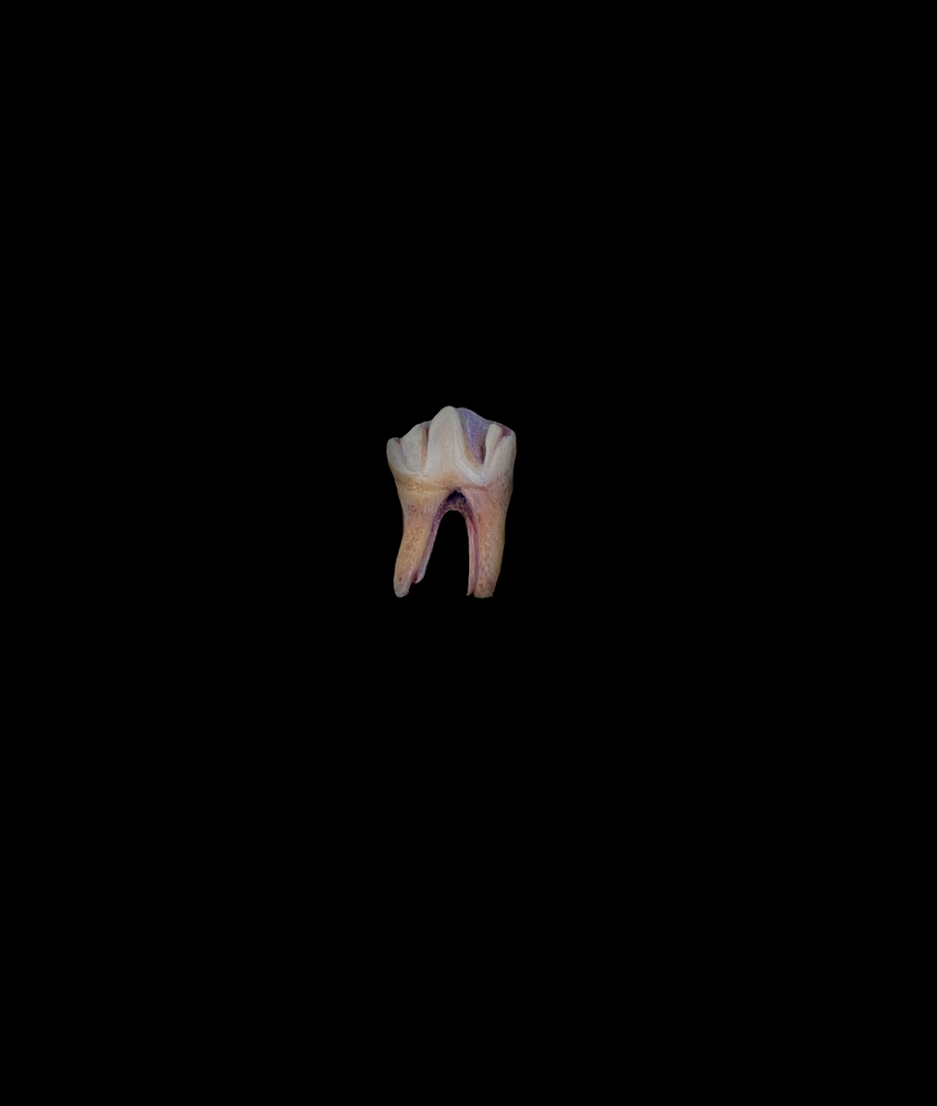Tiny Tooth by Tilly Woodward
