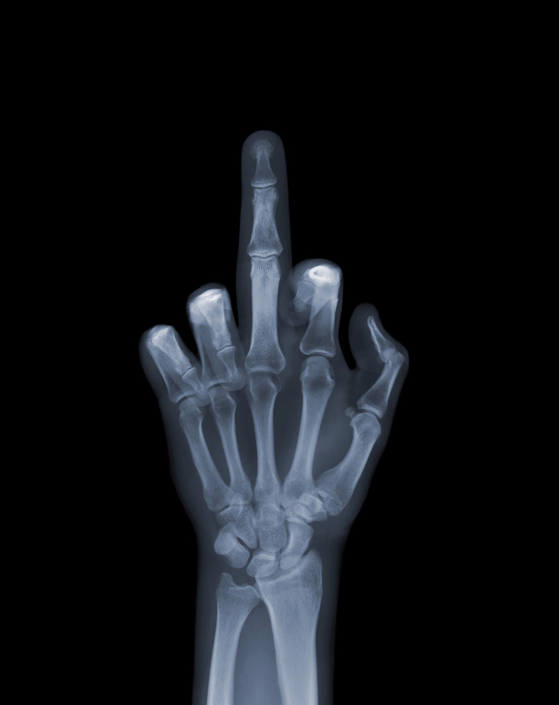 The Finger by Nick Veasey